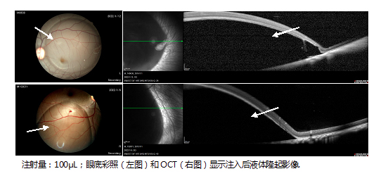 KBI非人灵长类动物视网膜下腔注射技术为基因疗法助力-广东网站制作
